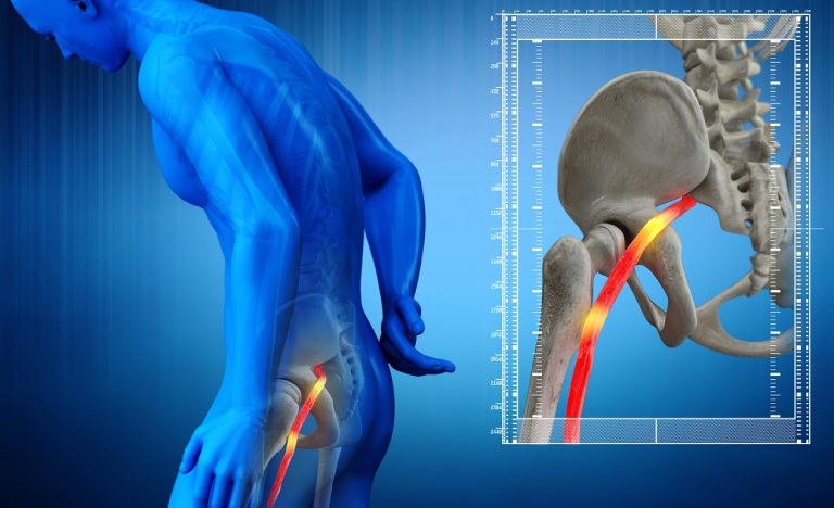 YHCT thường chú trọng điều trị toàn diện để duy trì hiệu quả lâu dài, ngăn ngừa bệnh tái phát