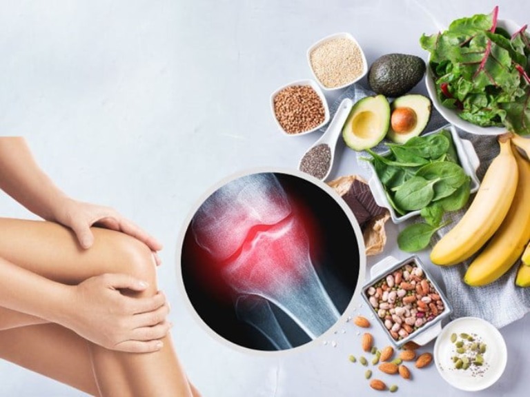 Chế độ ăn uống, sinh hoạt cũng cần điều chỉnh phù hợp để góp phần cải thiện sức khỏe xương khớp