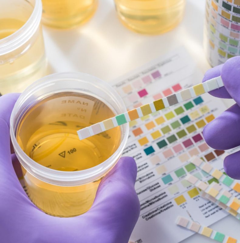 Màu nước tiểu phản ánh sự cân bằng âm dương và tình trạng tạng thận – bàng quang