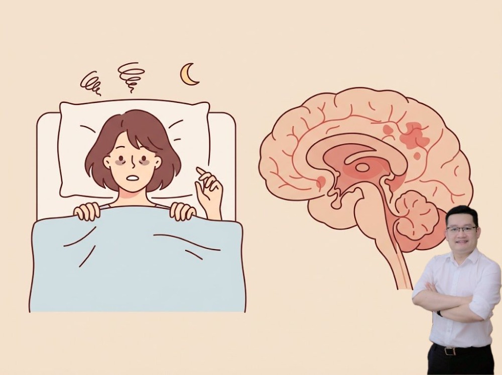 mất ngủ có làm tăng nguy cơ đột quỵ không? mất ngủ có làm tăng nguy cơ đột quỵ không?